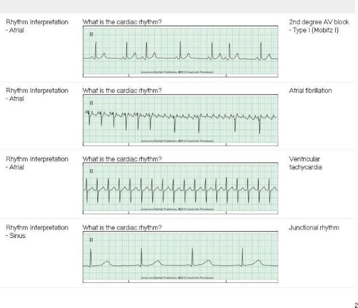 Dysrhythmia basic a relias answers